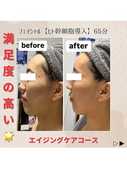 きれい塾 恵比寿/1回の施術結果