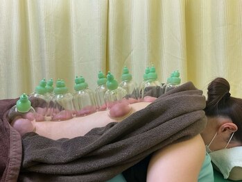 光幸はりきゅう院接骨院/吸い玉☆筋膜リリース/リンパ