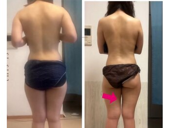 オーシャンブルーム 目黒(OceanBloom)/半年の変化12回目