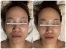 コニワ(528hz)/シンメトリー整顔Before⇔After