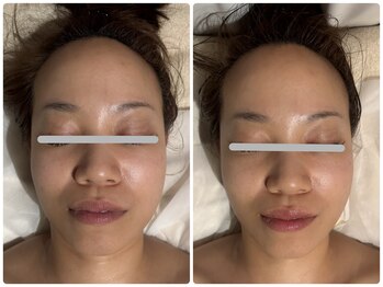 コニワ(528hz)/シンメトリー整顔Before⇔After