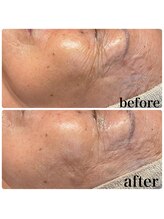 ディオーネ 春日井勝川店(Dione)/マーメイドセルトリートメント