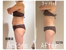 美活ラボ(美活LABO)/ブライダル