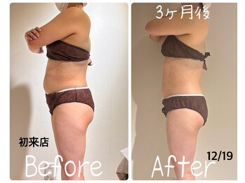 美活ラボ(美活LABO)/ブライダル