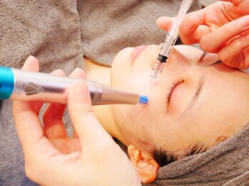 カリスボーテ 関本店の写真/ついに解禁!本気のシワ改善!韓国最新美療【水光ボツリヌスフェイシャル ¥13200】ほうれい線/目元/額/首に◎