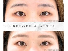 シュシュ(shushu)/まつげパーマ&アイブロウセット