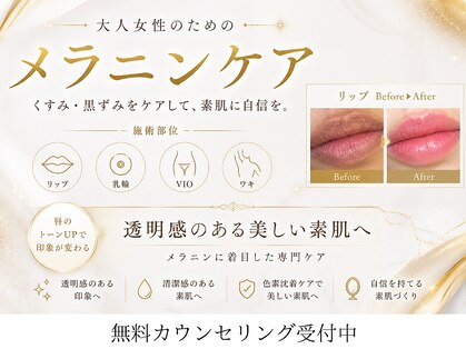 モンロー(MonroE+)の写真
