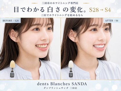 ダンブランシュサンダ(dents Blanches SANDA)の写真