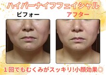 グローアップ(Glow up)
