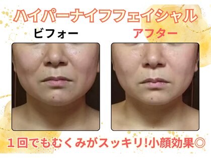 グローアップ(Glow up)の写真