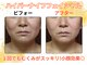 グローアップ(Glow up)の写真