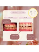 プラスビーセルフ(+b self)/ビフォーアフター