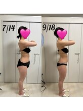 リノ ポノ(Lino Pono)/ビジリスと痩身の組み合わせ