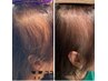 髪の悩みに◎幹細胞培養上清液導入ノアグロウスカルプトリートメント