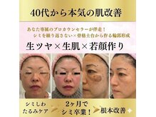 グラン ソレイユ(GRAN SOLEIL)