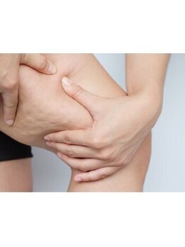 エピア 半田店(Epia)の写真/リバウンドしにくいダイエットで理想のボディを手に入れましょう！