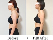 ビコツプロ(Bikotsu Pro)の雰囲気（猫背・巻き肩改善で顔のたるみも変わる。見た目印象が変わる！）