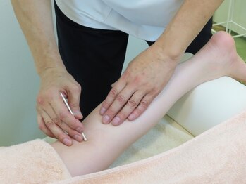 かつらはりきゅう 小児しん/足へのていしん施術