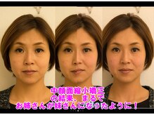 ビープラス 札幌整体院の雰囲気（左がbefore、右がafter、真ん中はbeforeとafterの左右の合成です）