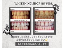 ホワイトニングショップ 西日暮里店