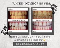 ホワイトニングショップ 西日暮里店