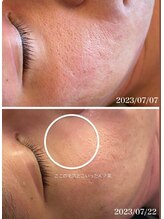 スリリアン 銀座/★お客さまビフォーアフター★