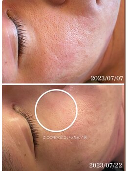 スリリアン 銀座/★お客さまビフォーアフター★