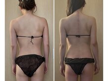 ココア(CoCoa)の雰囲気（新感覚！コリも浮腫も吸われてスッキリ♪活性リンパ洗浄）