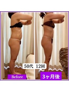 グラチア(Gratiae)/50代/3ヶ月全身ダイエットコース