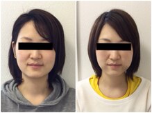 美容整体 ウェリナ 蟹江院/小顔矯正/骨盤矯正/美脚サロン