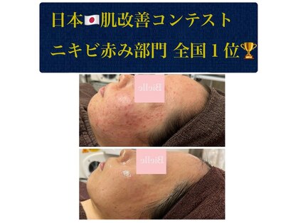 ビエル(Bielle)の写真