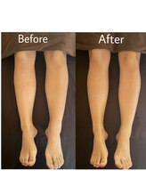 ベル 長崎(Belle)/ビフォーアフター