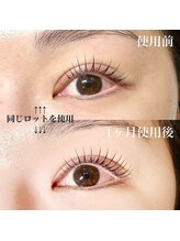 マツエク/まつげパーマ/パリジェンヌ/眉毛/LED etora池袋/ラッシュアディクト効果