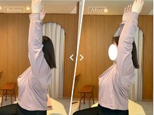 リリーフポート フェミナ鍼灸整体院 大濠公園店/お悩み：肩甲骨の痛み