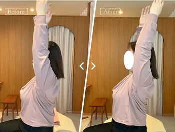 リリーフポート フェミナ鍼灸整体院 大濠公園店/お悩み：肩甲骨の痛み