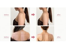 カムズビューティー(Comes beauty)/肩甲骨のライン整う