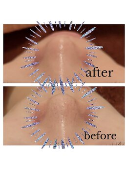 パリス デ スキン フォーメン 岐阜マーサ21店(Paris de skin for Men)の写真/メンズフェイシャルエステで毛穴洗浄！黒ずみやざらつきをオフして理想の美肌を目指すケア体験☆