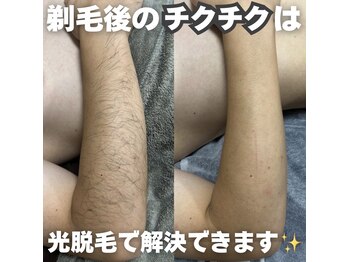 カナウ(KANAU)の写真/【全身脱毛14,500円/都度払い◎】全身綺麗にしたいけど予算が決まっている・ローンを組みたくない方へ！