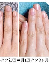 桃の木 吉祥寺店/自爪が綺麗が最強！