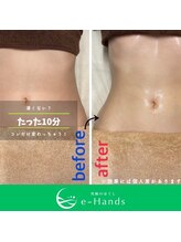 イーハンズ 福岡店(e-Hands)/【お客様施術例】