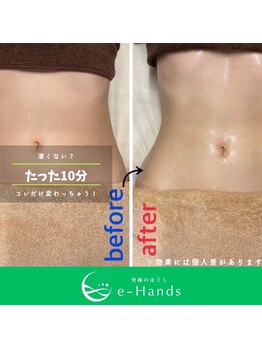 イーハンズ 福岡店(e-Hands)/【お客様施術例】