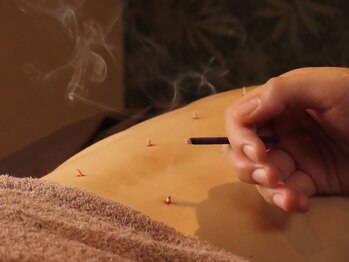 リ フリー 宮の森店(Re'free)/免疫を鍛えるならお灸