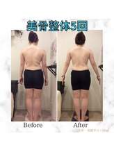 ミエル(Miel)/Before After