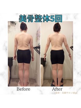 ミエル(Miel)/Before After