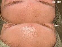 リボーン 浜松(reborn)/