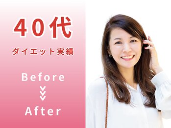 スロース鍼灸整体院(SLOTH鍼灸整体院)/40代 ダイエットBefore/After