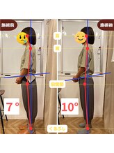 ふらっと/30代前半/会社員 骨盤の不安定感