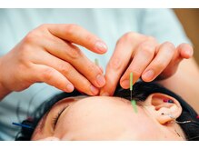 中村温灸院/美容鍼