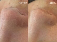 テオリア(TEORIA)/