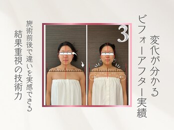 リス ブラン ビューティー(Lys blanc beauty)/変化分かるビフォーアフター実績